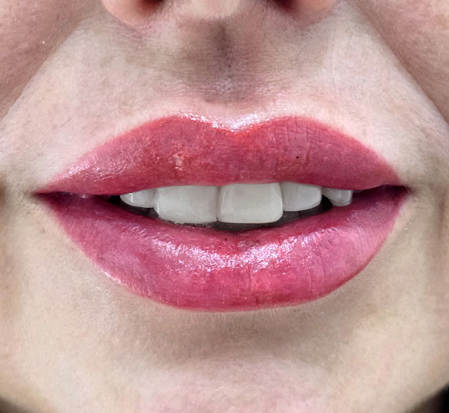 Micropigmentación de labios en Madrid